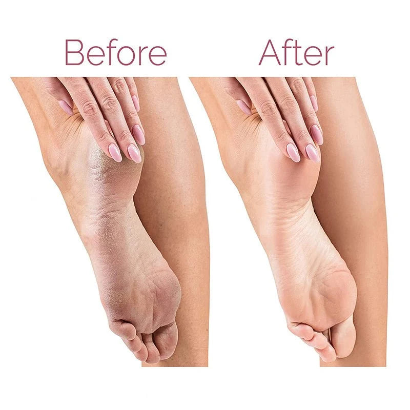Rechargeable Electric Pedicure Foot File & Callus Remover